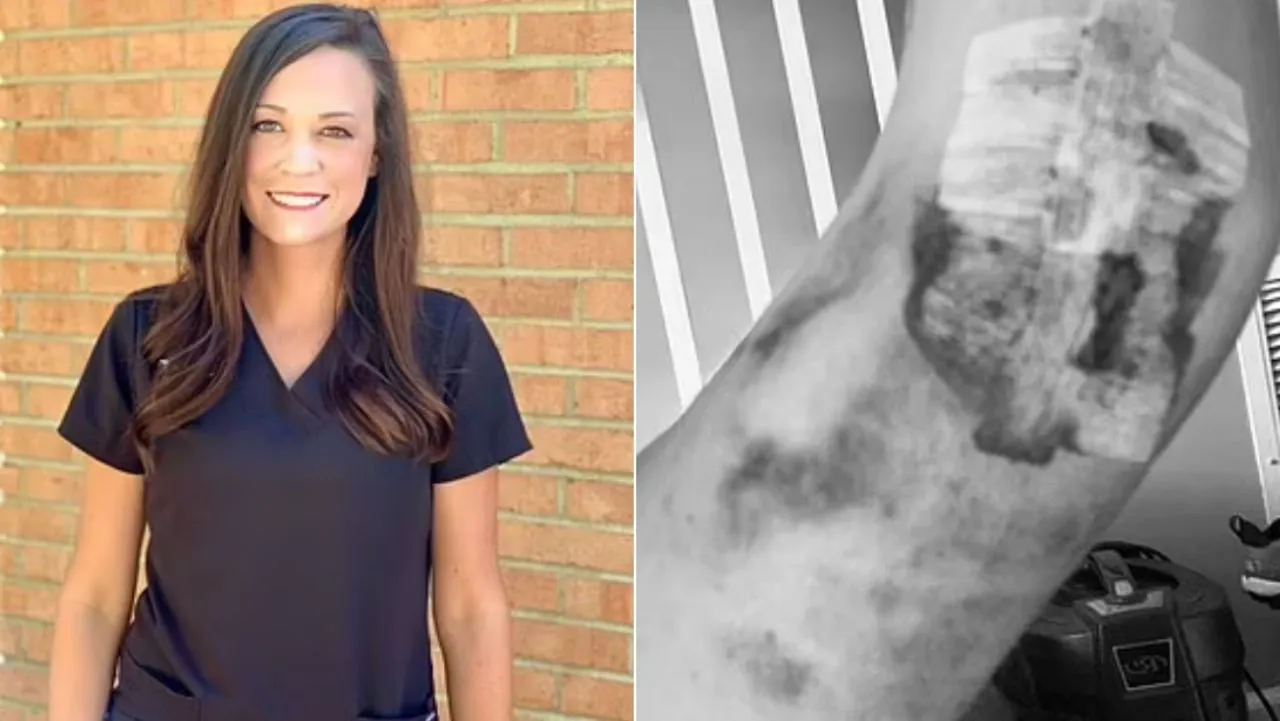 Betrayed by the Science: Doctors Confirm COVID Shot Linked to Devastating Bone-Rotting Condition